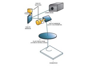 Galvanometer Laser